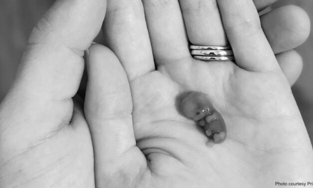 Women More Likely to Face Mental Health Problems After Abortion Than After Birth