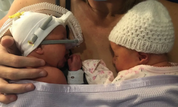 Doctors Told Mom to Abort a Disabled Twin, She Refused and Both Babies are Doing Great