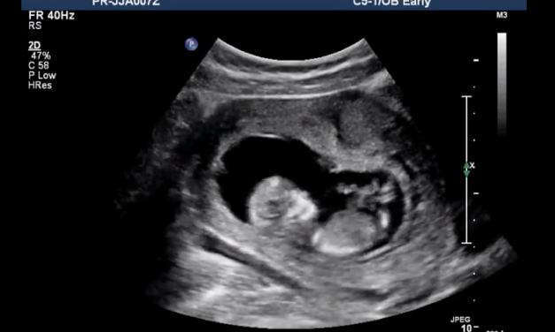 The Alabama Supreme Court Was Right: Unborn Babies are Human Beings