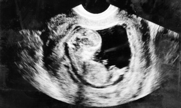 Woman Changes Her Mind on Abortion After Hearing Her Baby’s Heartbeat
