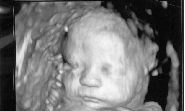 State Ballot Measures Would Legalize Abortions Up to Birth, We Must Fight Them