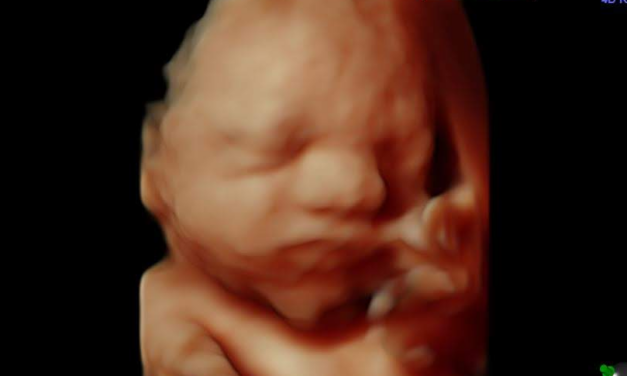 France Becomes First Country in the World to Make Killing Babies in Abortions a Constitutional Right