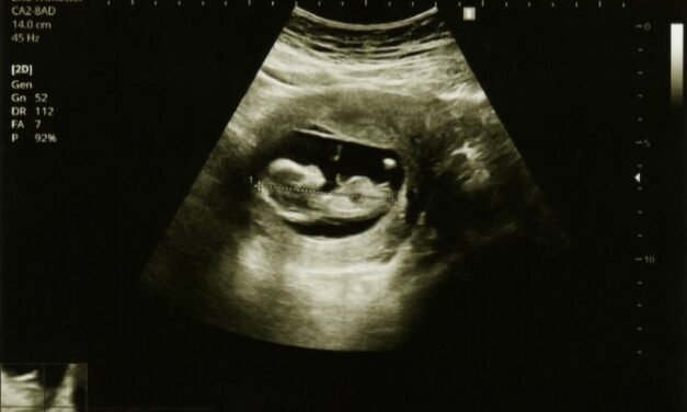 Norway bishops: Proposal to expand abortion abandons ‘Christian and humanistic heritage’