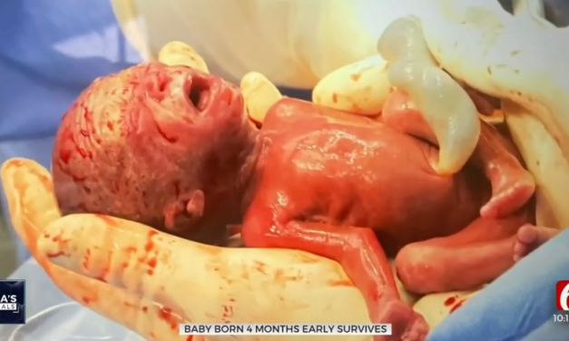 Premature Baby Born the Size of a Soda Can Beats the Odds, Celebrates First Birthday