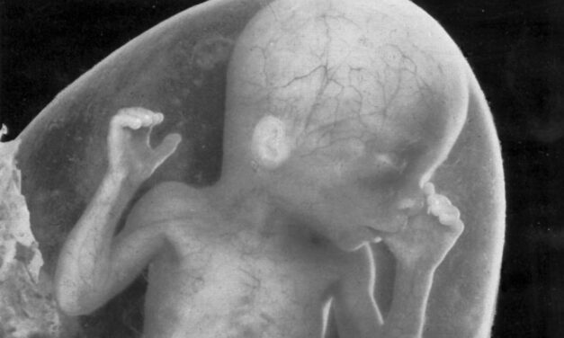 Florida’s Amendment 4 would actually allow unlimited abortion. Here are the facts.