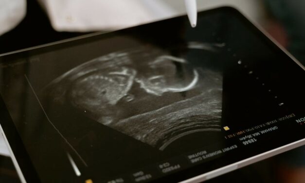 Is aborting someone OK if we won’t miss them?