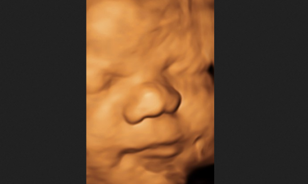 Colorado and South Dakota Will Vote on Ballot Measures for Abortions Up to Birth