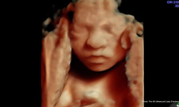 UK MP introduces amendment to allow abortion up to birth