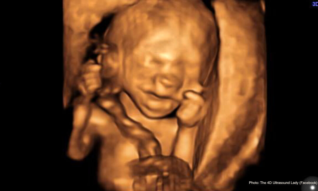 Late-term abortionist’s document: Carrying to term safer for women than abortion at 18+ weeks