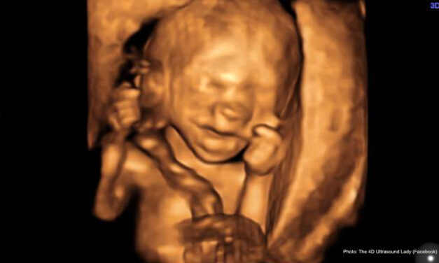 Late-term abortionist’s document: Carrying to term safer for women than abortion at 18+ weeks