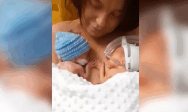 Twin Premature Babies Born at 29 Weeks Defy the Odds