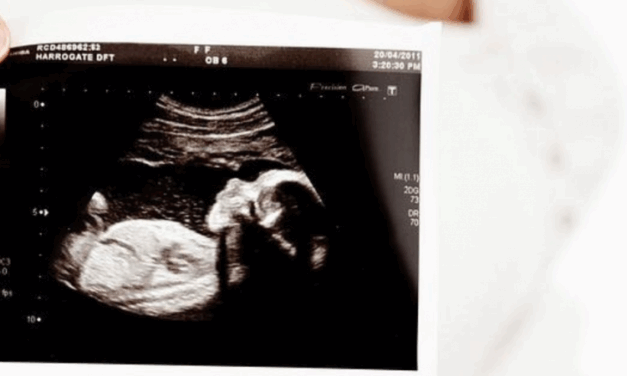 Trump Administration Praised for Cutting Funding to Research Involving Aborted Babies