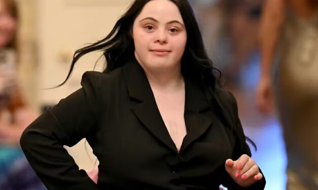 A nurse urged this Vogue model’s mother to abandon her at the hospital