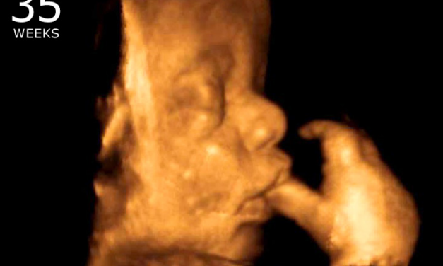 Catholic Bishops Blast Abortion: “Thousands of Unborn Children Lose Their Lives Every Month”