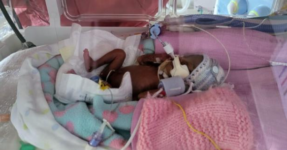 Premature Baby Born at 22 Weeks and Weighing 13 Ounces Heads Home From Hospital