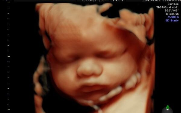 Study Shows Unborn Babies Experience Consciousness