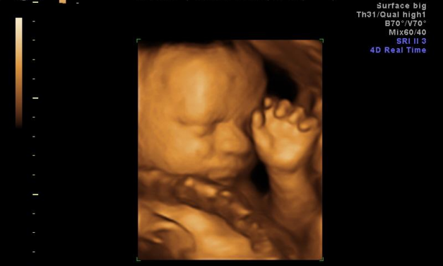 California Loses Attempt to Force Taxpayers to Fund Abortions