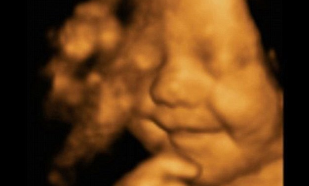 We Have to Stop Abortions Up to Birth in Virginia